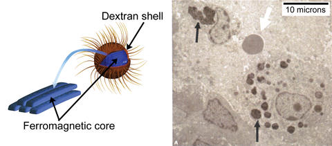 An illustration of an iron-centered nanoparticle and a micrograph of a tumor cell ingesting the nanoparticle