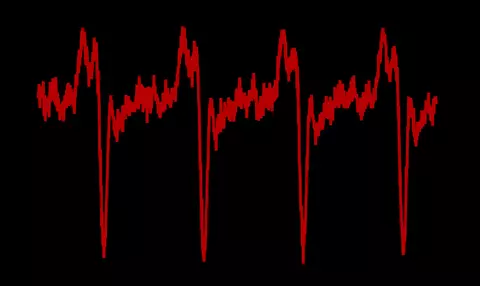 Colorized trace of pulses from the NIST/JILA "dark pulse" laser