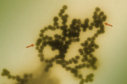 Transmission electron micrograph of gold nanoparticles clustering in solution.