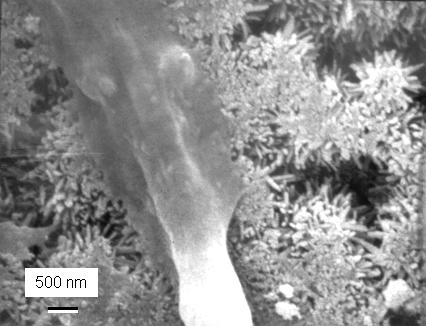High-magnification scanning electron micrograph of the leg of an osteoblast