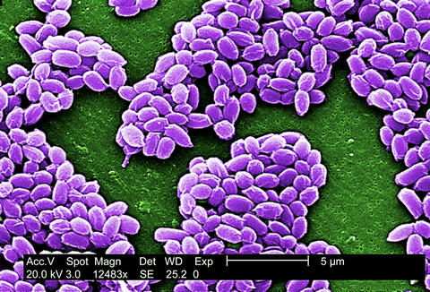 This scanning electron micrograph shows spores from the anthrax vaccine strain of Bacillus anthracis.