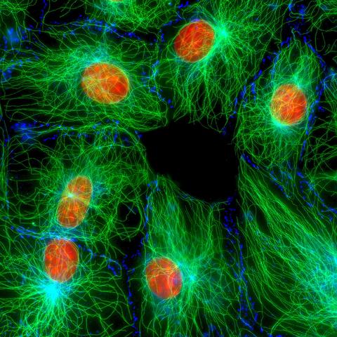 A fluorescent microscope image of NIH 3T3 fibroblast cells