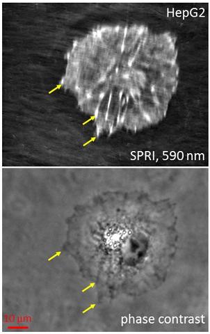 High resolution measurement of cellular focal adhesions
