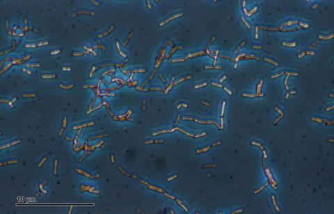 micrograph of lactobacillus acidophilus