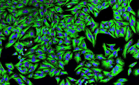 Monoclonal Antibodies Bound to HeLa Cells In this image, we see green wherever monoclonal antibodies have attached to cancer cells.