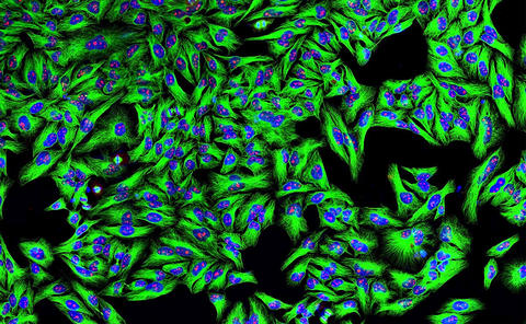 In this image, we see green wherever monoclonal antibodies have attached to cancer cells.