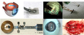 Collage of Neural Implant Images