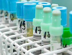 Shutterstock image of test tubes