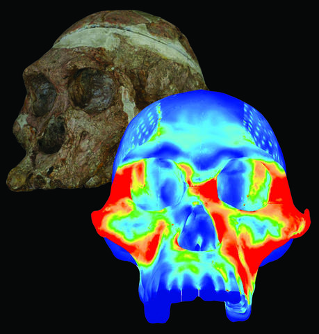 Finite Element Model and Color Mapping of Cranium