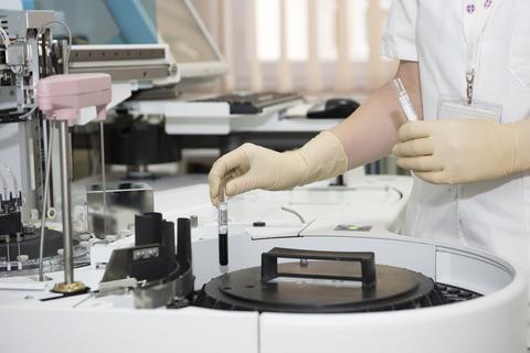 Scientist analyzing samples in the lab