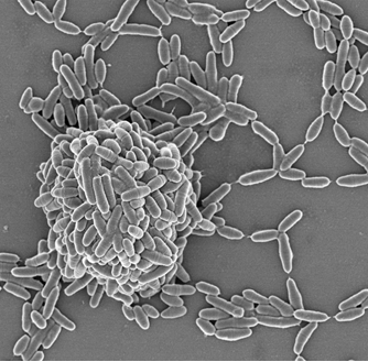 S Mutans SEM image, in the process of forming complex networks.