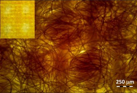 Cotton flannel fibers Micrograph shows coiled fibers on yellow background with inset of lighter yellow square.