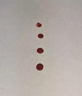 Photo of blood droplets