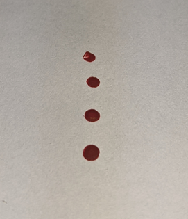 Photo of blood droplets