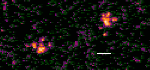 Alpha tracks in a phosphor imaging plate