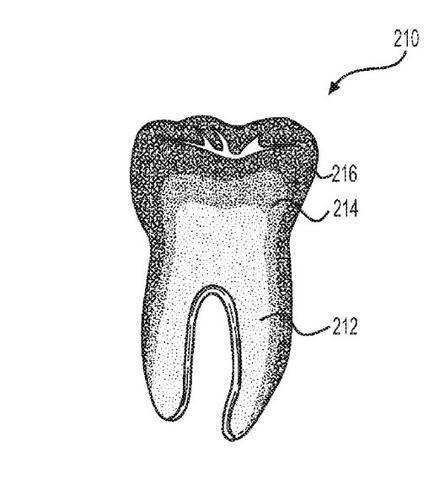 black and white drawing of a tooth