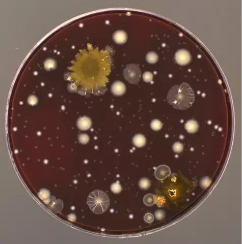 Petri dish holds brown material with several different types of circular microbes.