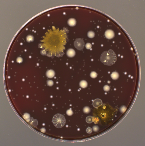 Petri dish holds brown material with several different types of circular microbes.