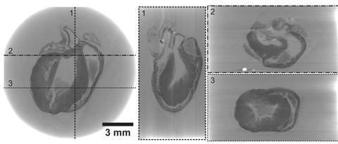 Mouse Heart XPCI imaged