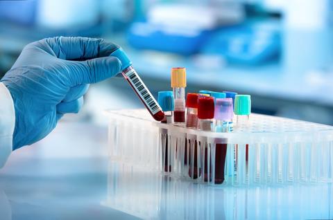 Gloved hand with blood sample from a sample rack, in a clinical laboratory.