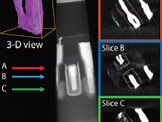 TEM microscopy modelling