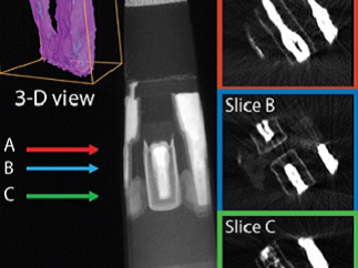 TEM microscopy modelling