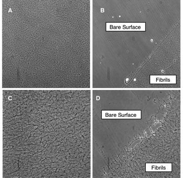 collagen phase contrast