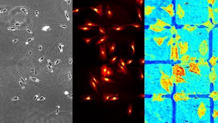 SPRI cells