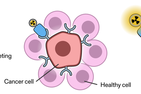 Diagram shows a radioisotope attached to a cancer-targeting molecule and how the molecule attaches to a cancer cell and injects alpha radiation. 