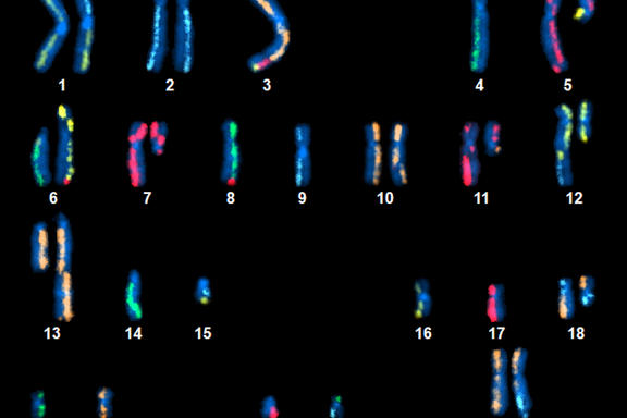 An image showing 22 pairs of numbered and color-coded chromosomes on a black background.