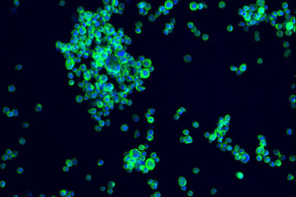 A microscopic image of NISTCHO cells that are stained blue and green on a black background..