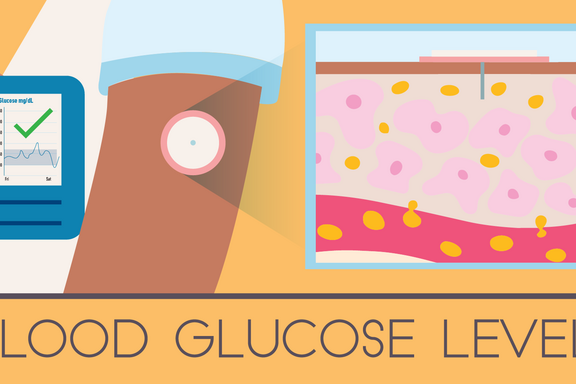 Illustration labeled Blood Glucose Levels shows a person holding a phone next to round monitor on their arm; inset shows cross-section of needle in skin. 