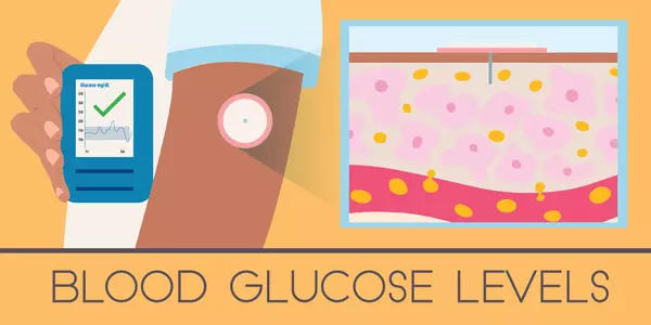 Illustration labeled Blood Glucose Levels shows a person holding a phone next to round monitor on their arm; inset shows cross-section of needle in skin. 