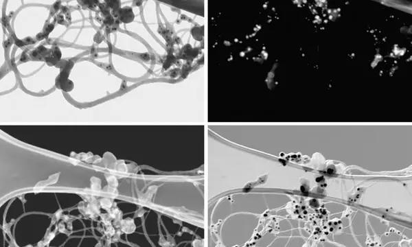 t-SEM images of single wall carbon nanotube bundles with metal catalyst particles. Image width = 1 μm.