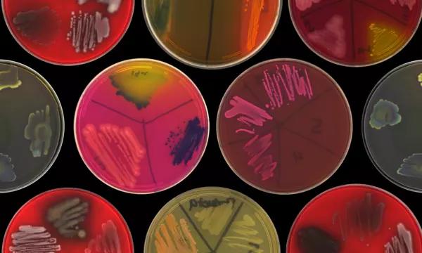 Microbial Strain