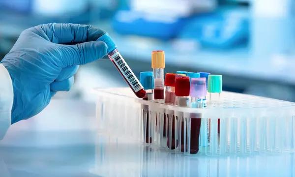 Gloved hand with blood sample from a sample rack, in a clinical laboratory.