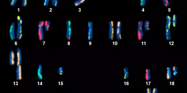 An image showing 22 pairs of numbered and color-coded chromosomes on a black background.