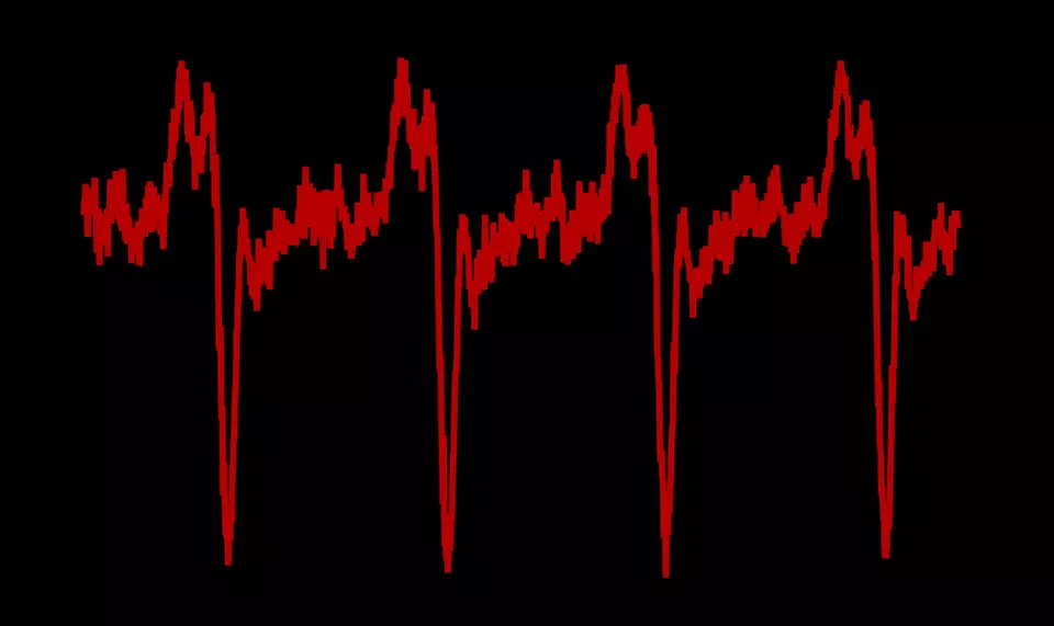 Colorized trace of pulses from the NIST/JILA "dark pulse" laser