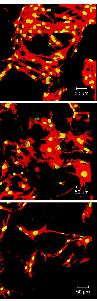 Confocal microscope images show how growth and adhesion of bone cells differ across a subset of 3-D scaffolds made with systematically varying blends of ingredients. 