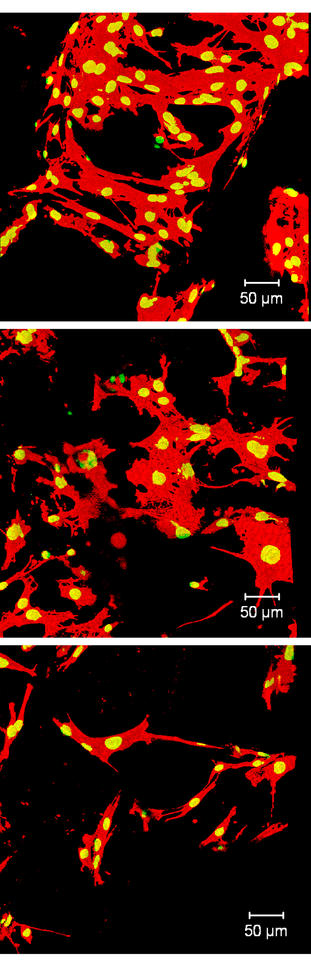 Confocal microscope images show how growth and adhesion of bone cells differ across a subset of 3-D scaffolds made with systematically varying blends of ingredients.