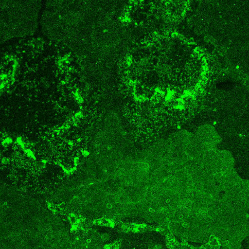 Deposits of hydroxyapatite crystal light up bright green where they've been tagged with a new peptide