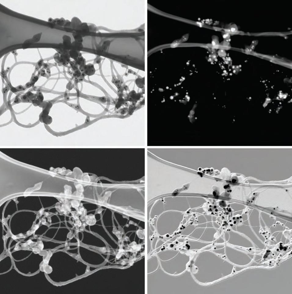 t-SEM images of single wall carbon nanotube bundles with metal catalyst particles. Image width = 1 μm.
