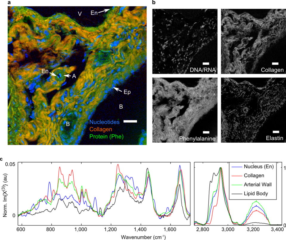 BCARS image of murine liver tissue with various hepatic structures identified.