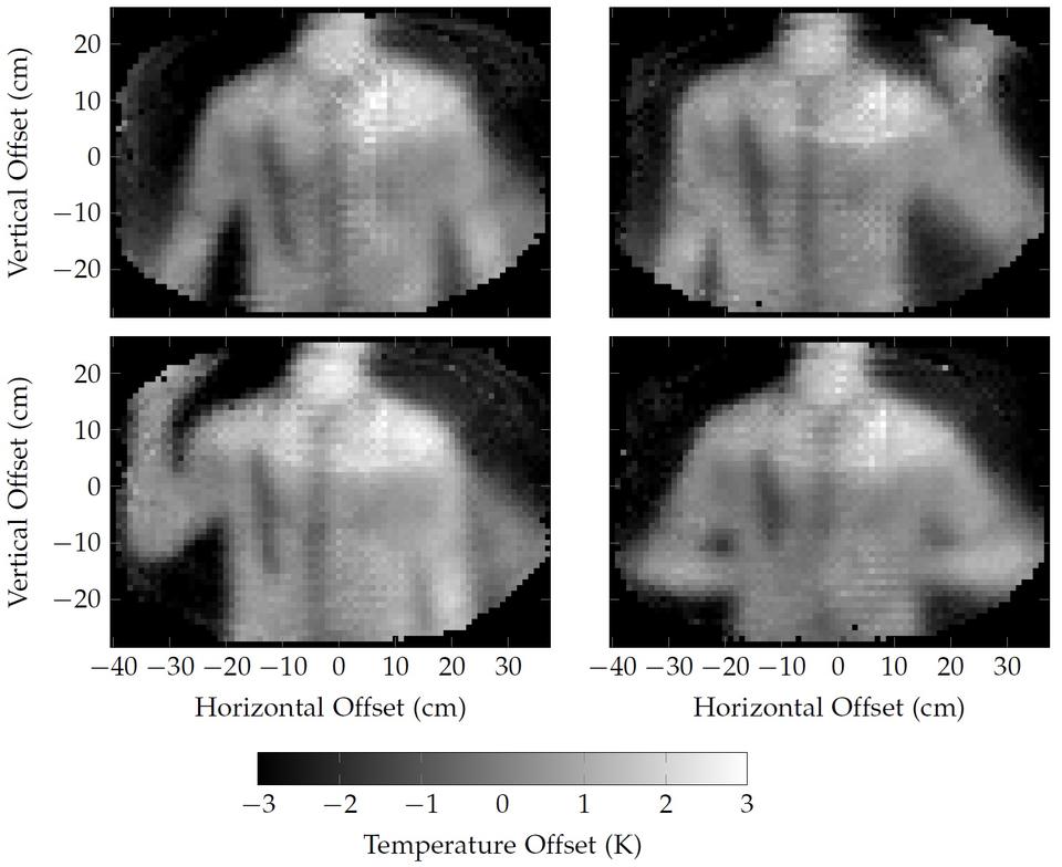 Still images from video captured by the 350 GHz Millimeter Wave system. A ceramic weapon is concealed beneath a person's shirt. The weapon' shape is visible using the 350 GHz system.