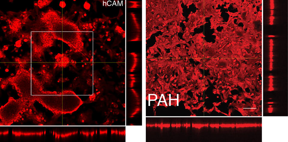 Box on left of red images on black background with hCAM, and on right with red images on black backgrounds with PAH