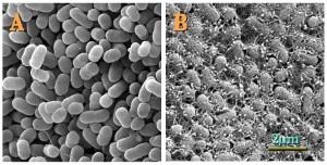 micrographs of E coli bacteria