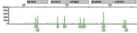 Cellular fingerprint: This electropherogram demonstrates the STR (short tandom repeat) technique NIST will use to identify human cell lines.