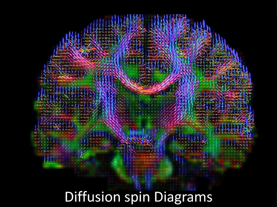 Brain wiring diagram