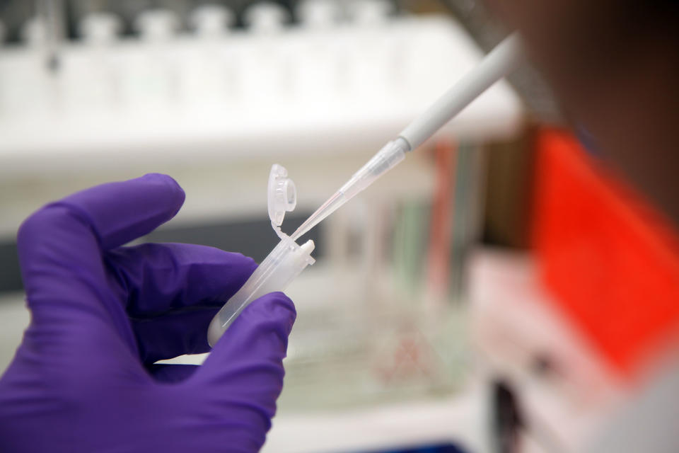 close up of a hand pushing milk into a vial