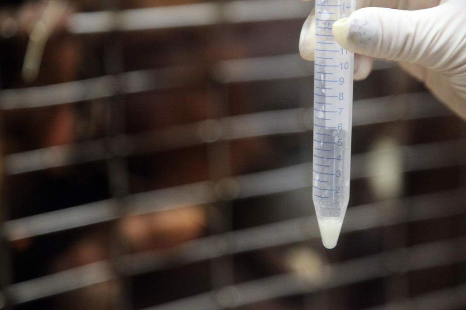 hand holding a vial filled with breast milk 